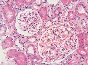 人肾图片,人体肾脏结构图解与功能概述